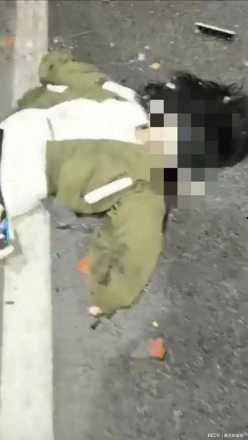 网红因为车祸毁容了,网红勇敢面对毁容挑战