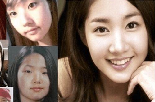 整容过的女明星都有谁,那些曾整容的当红女明星